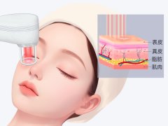 С����ͷ����İ̺���ȥ����