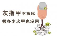 �Ͼ�Ƥ������ָ���������